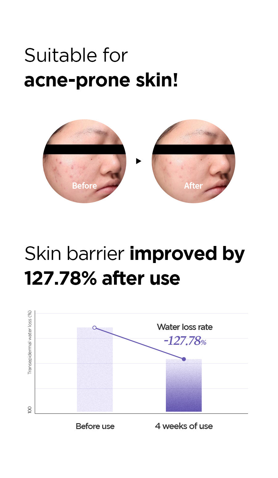 Isntree Onion Newpair B5 Ampoule 50ml