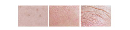 REJURAN Derma Healer Moisture Cream 60g
