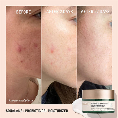 Biossance Squalane + Probiotic Gel Moisturizer 50ml