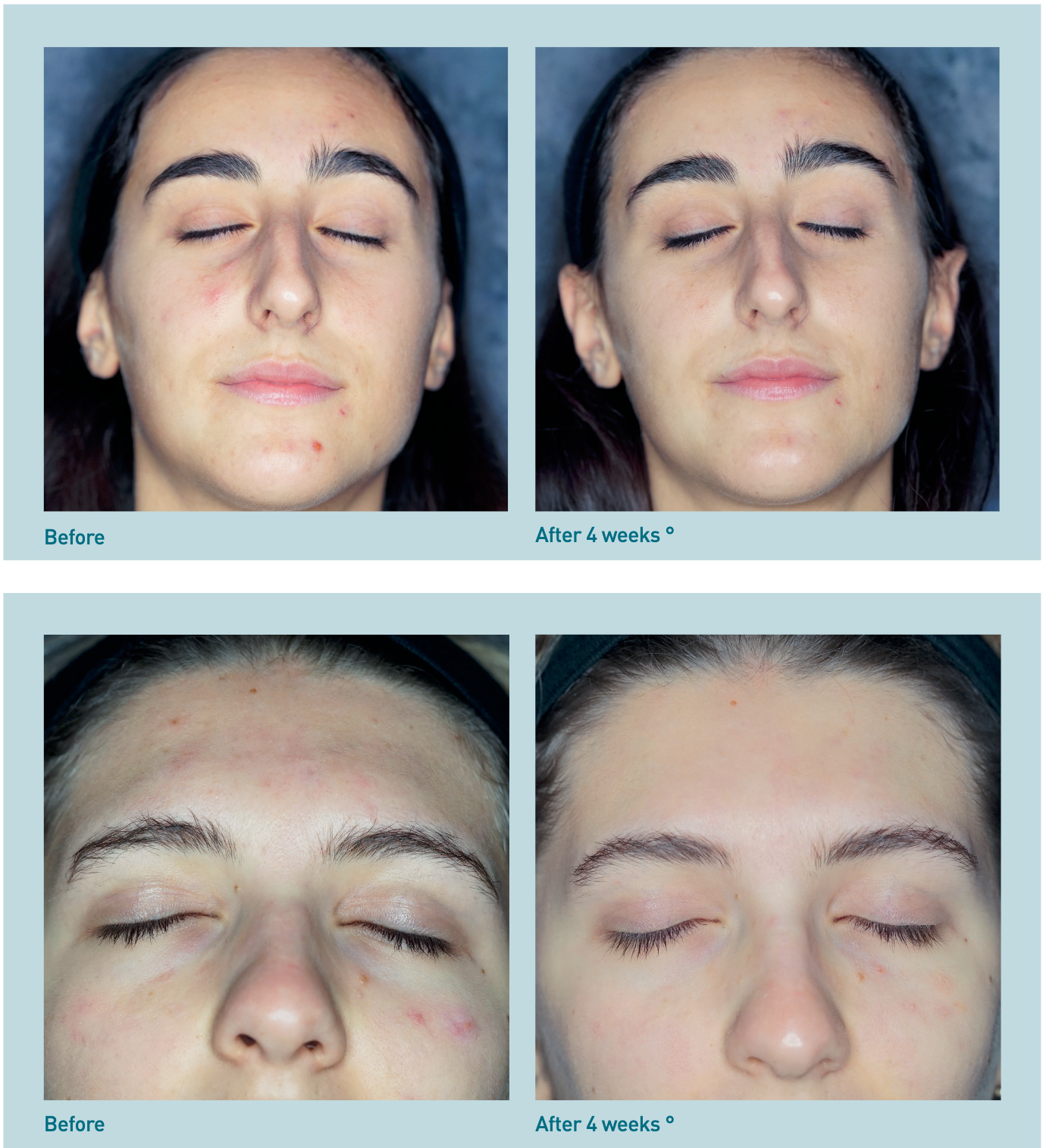WiQo Balancing Cream (1 x 30ml)